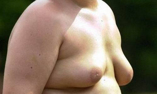 www.mallorcadiario.com  fotos 1 uploads 2012 09 hombre tetas col2 ok
